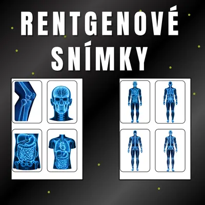 Rentgenové snímky
